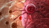 Созданы наночастицы, способные уничтожать метастазы рака груди